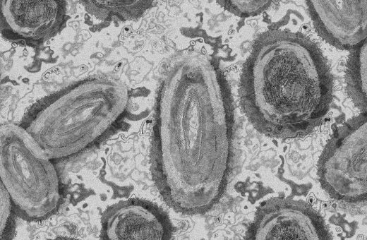 Kasus Pertama Infeksi Virus Shamonda pada Manusia Ditemukan di Prancis