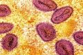 Pecah Rekor – Kasus Pertama Flu Burung Strain H5 Ditemukan di Australia, Diduga dari Burung Laut