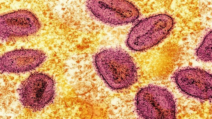 Pecah Rekor – Kasus Pertama Flu Burung Strain H5 Ditemukan di Australia, Diduga dari Burung Laut
